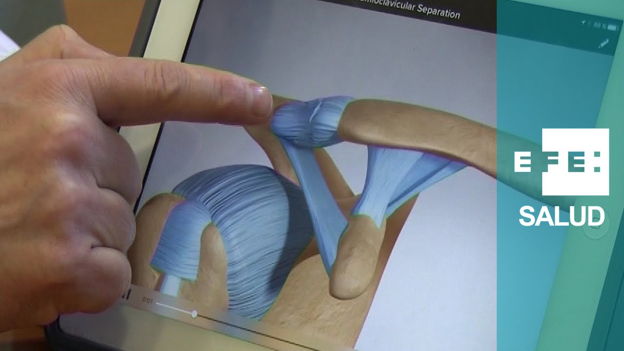 bulto en la clavicula izquierda sin dolor