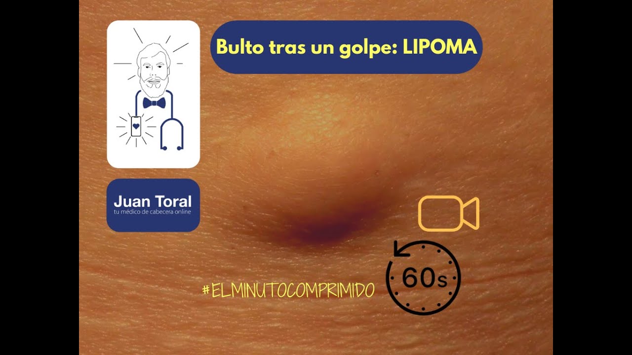 bulto en la frente después de un golpe