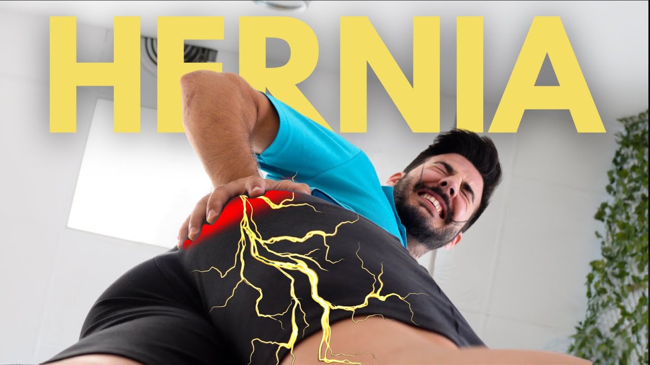 como aliviar el dolor de espalda por hernia discal