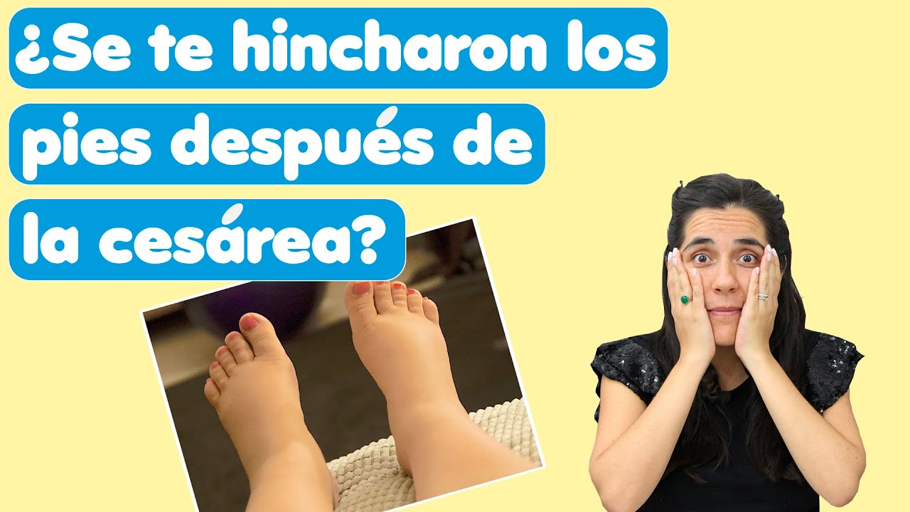 como bajar hinchazon de pies postparto