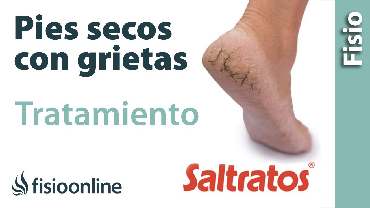 como curar las grietas de los talones