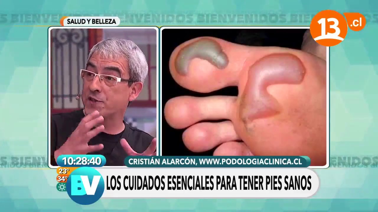 como curar una llaga en la planta del pie