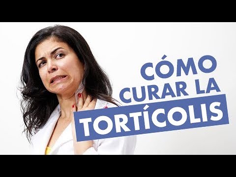 como quitar la torticolis en 20 minutos
