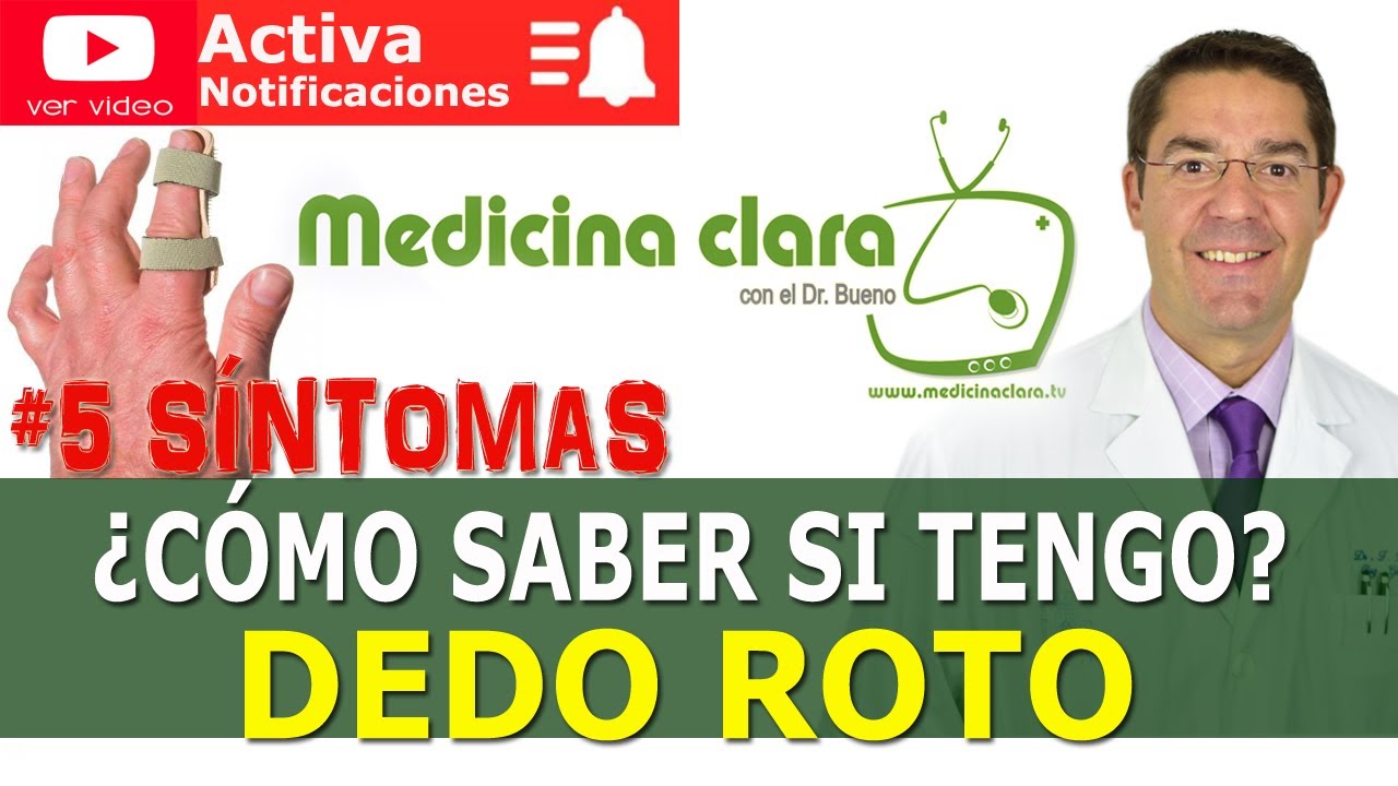 como saber si tu dedo esta roto