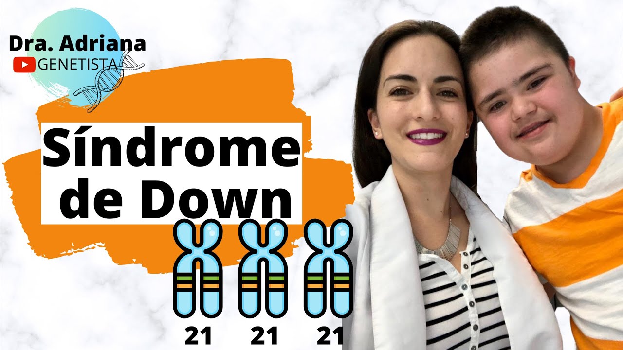 cuantos tipos de sindrome de down existen