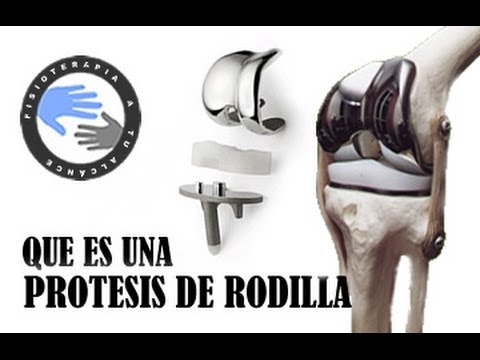 de que son las protesis de rodilla