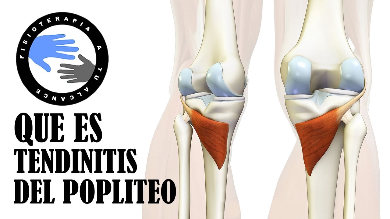 dolor de la corva de la rodilla