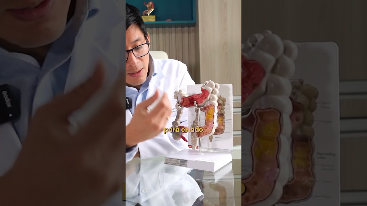 dolor intenso en la parte superior del abdomen