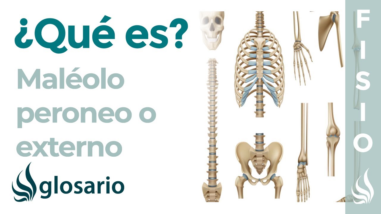 fractura del maleolo externo del tobillo