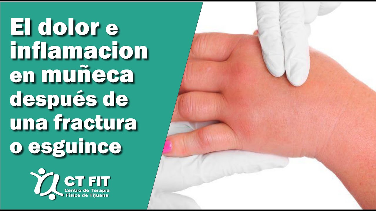 golpe en la mano hinchada y morada