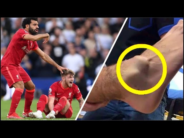 las lesiones mas graves en el futbol