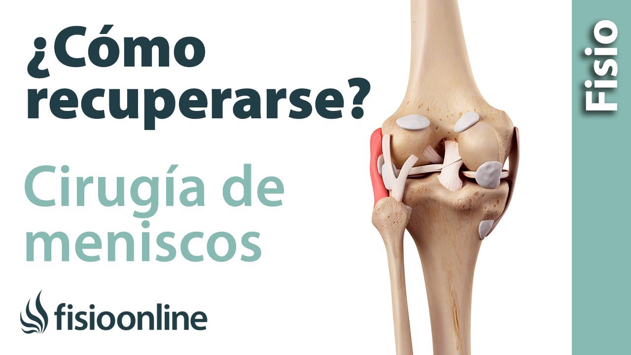 operación de menisco tiempo de recuperación