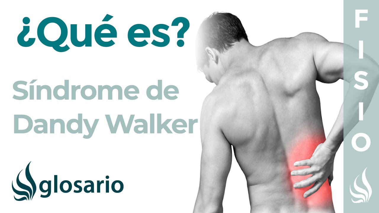 que es el sindrome de dandy walker