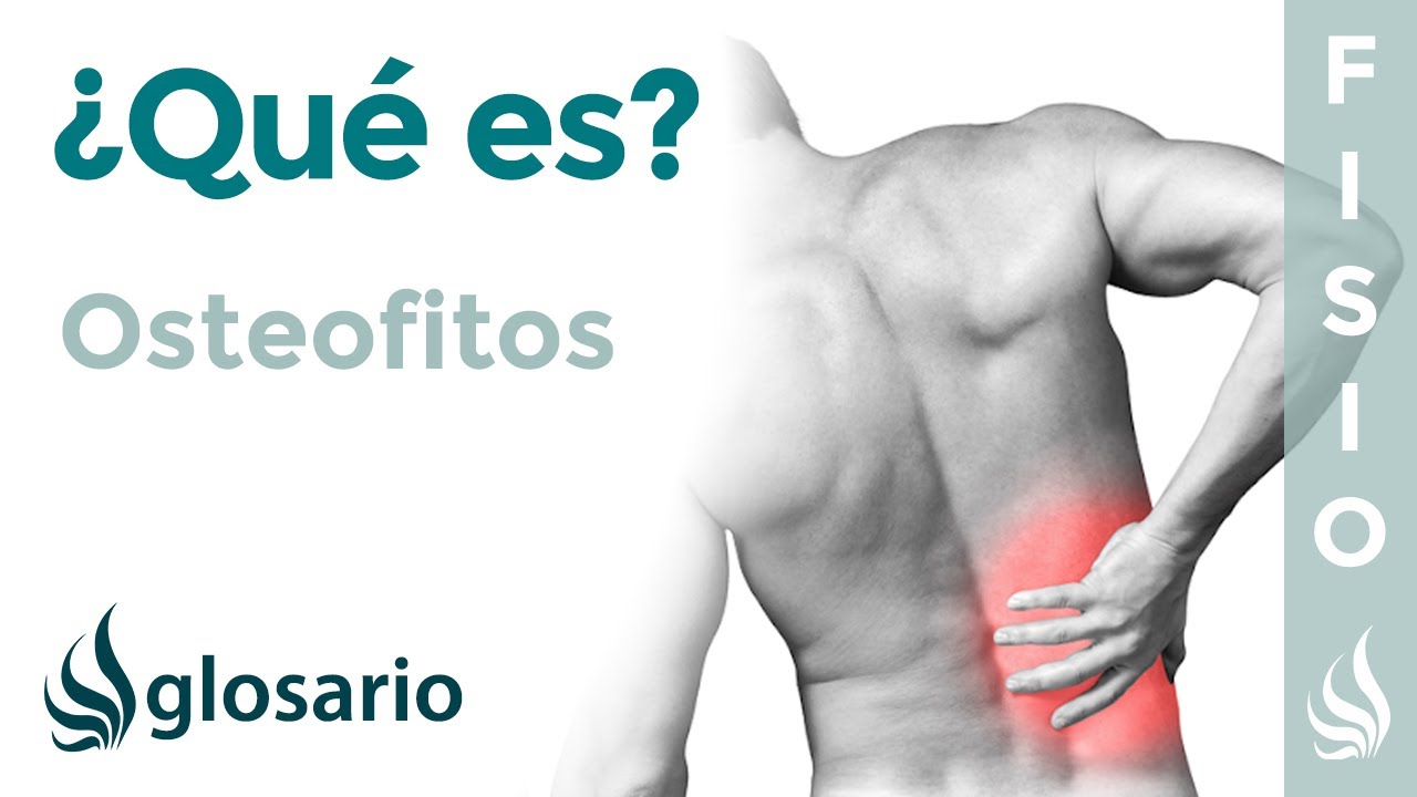 que son los osteofitos marginales lumbares