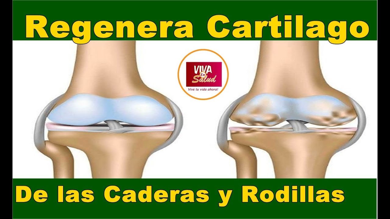 remedios naturales para regenerar las articulaciones