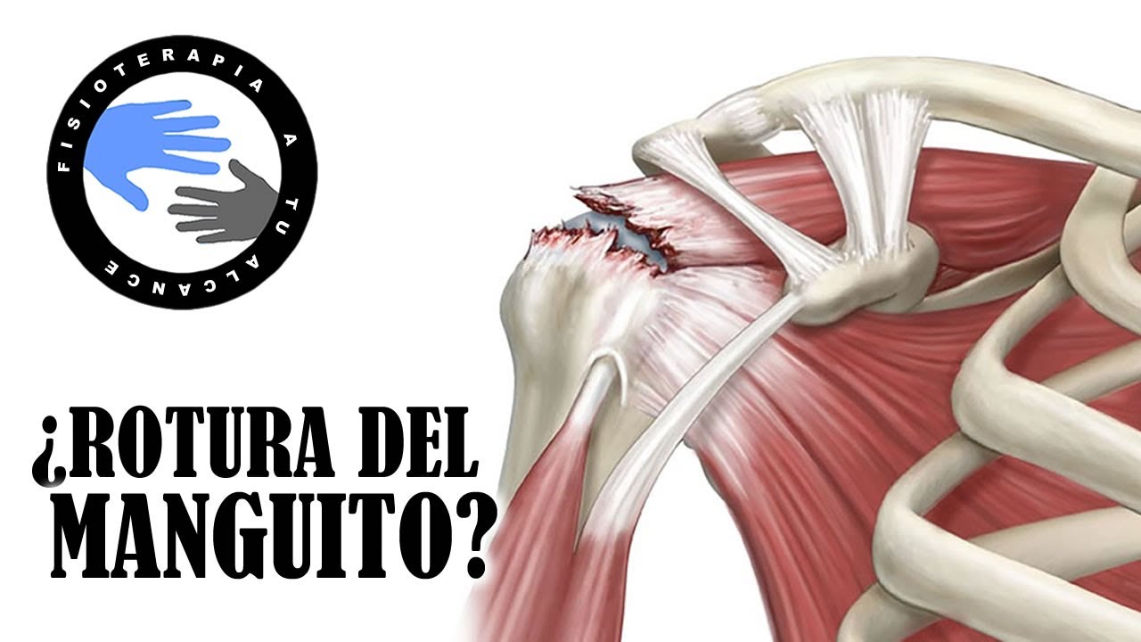 tipos de lesiones en el hombro