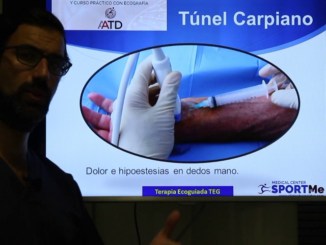 tratamiento para el tunel carpiano sin cirugia
