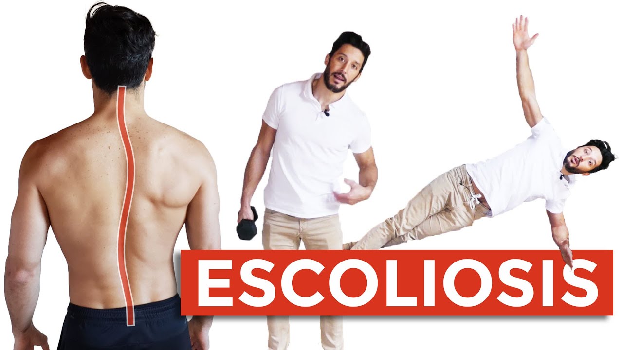 como calmar el dolor de la escoliosis