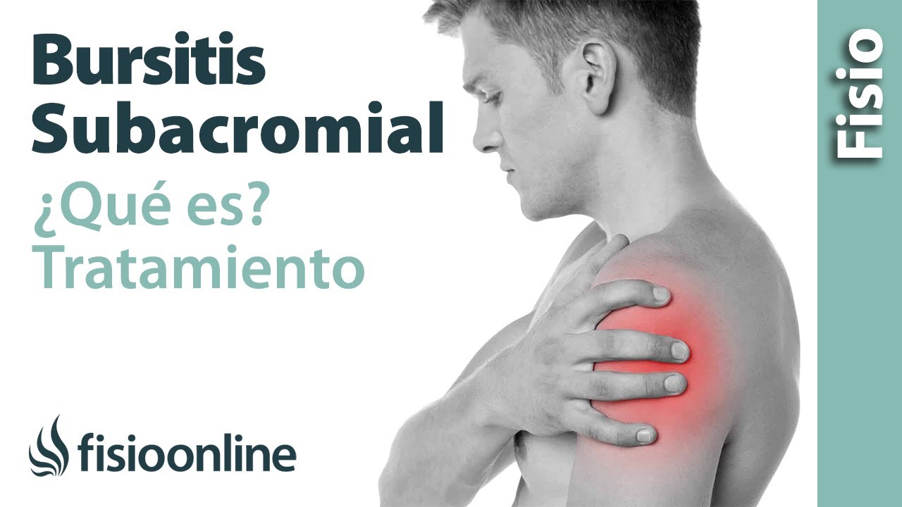 como curar la bursitis del hombro