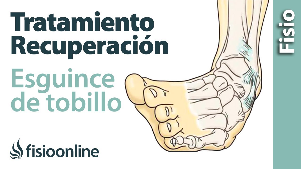 como recuperarse de un esguince de tobillo