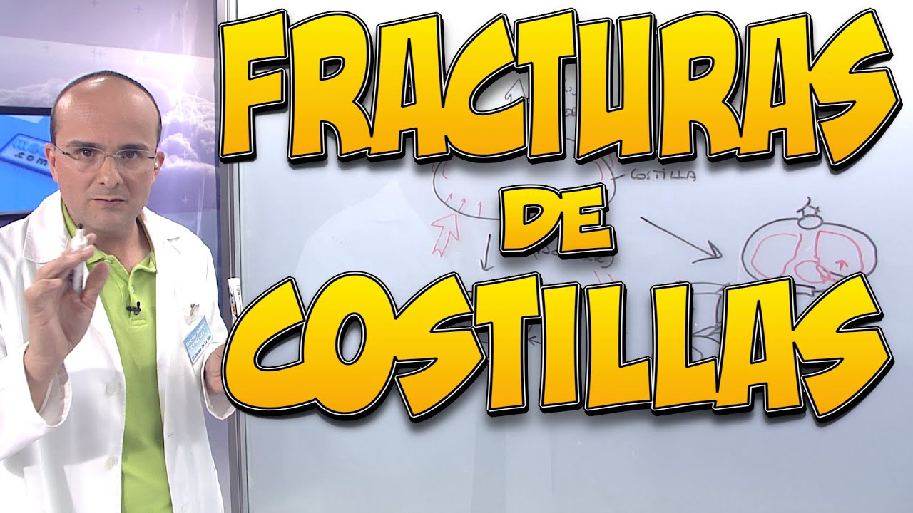 como saber si tengo una costilla fisurada