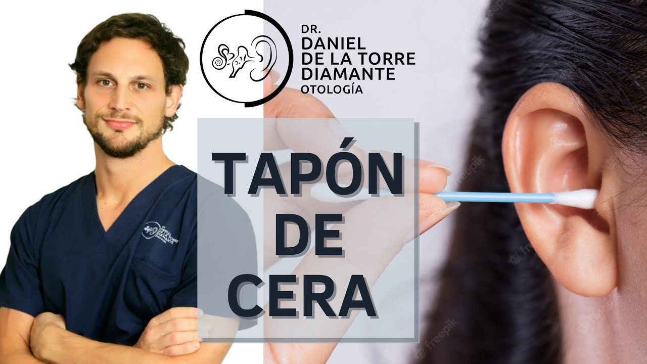 como saber si tienes un tapon en el oido