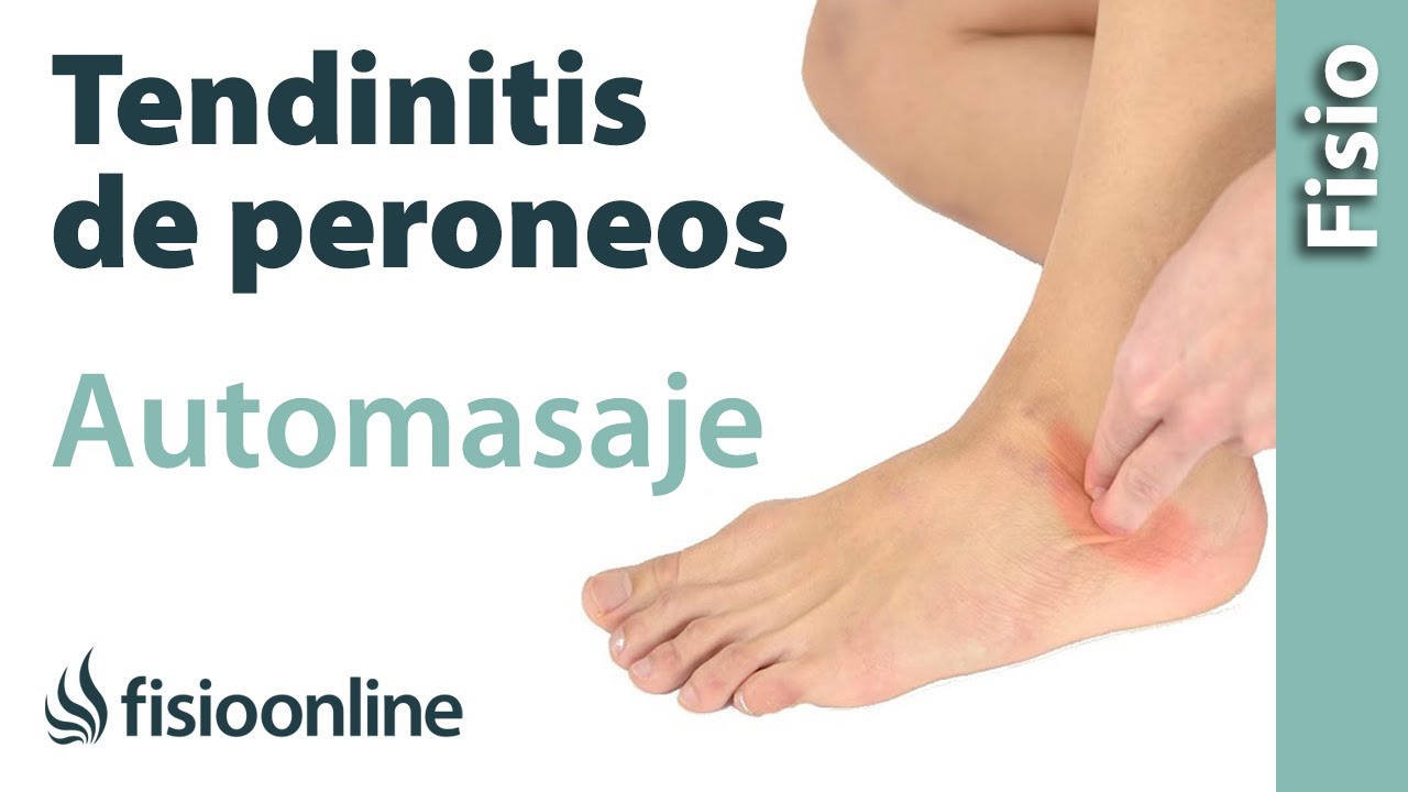 como se cura la tendinitis del pie