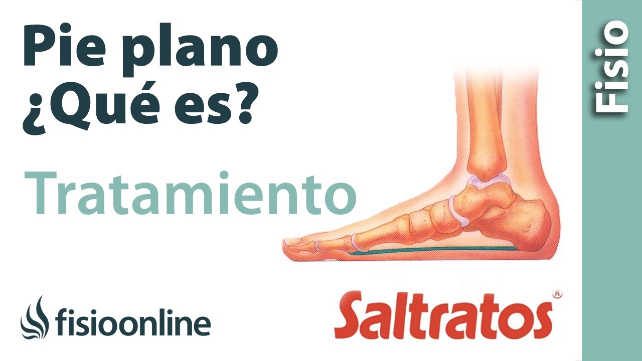 como se llama el doctor de los pies planos