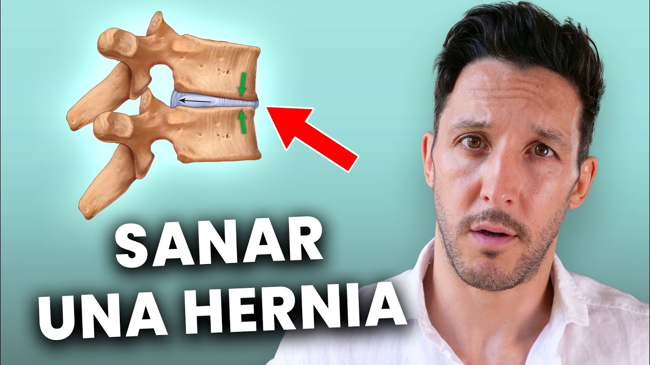 como tratar una hernia discal lumbar