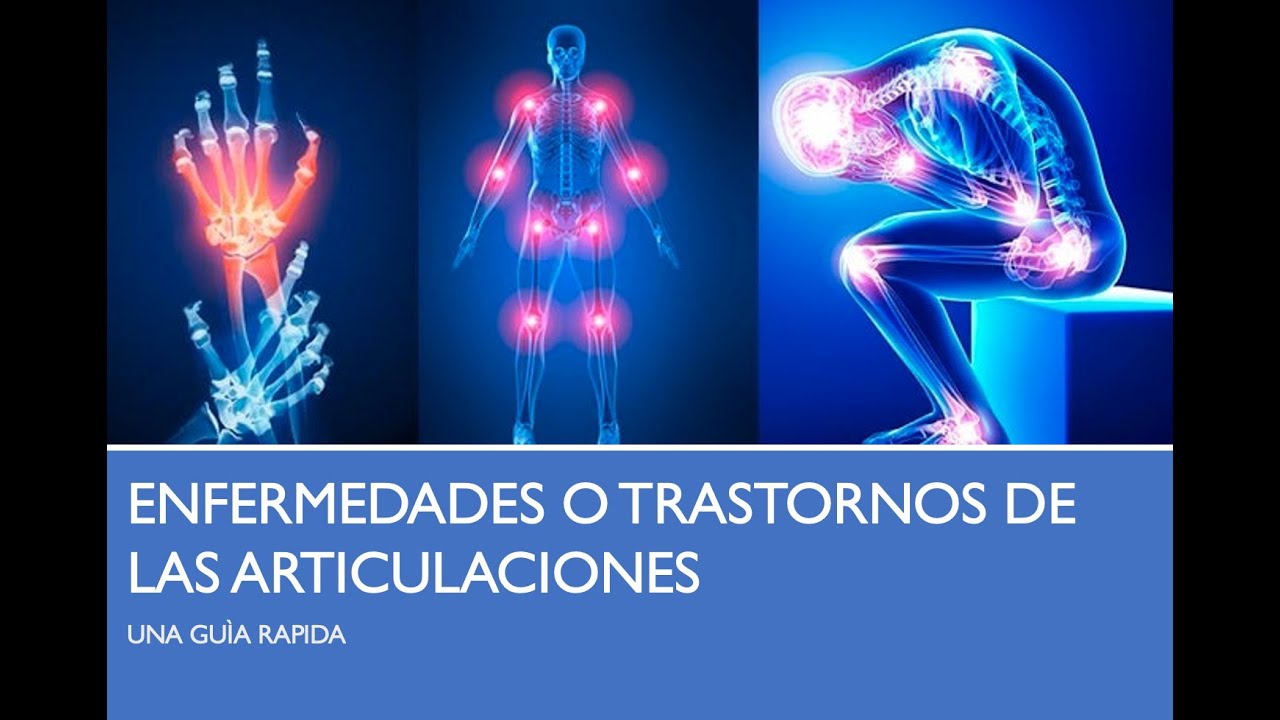 cuales son las enfermedades mas comunes de las articulaciones