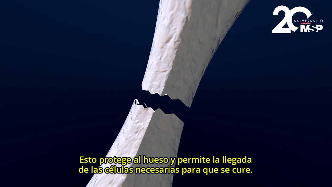 cuanto tarda en soldar un hueso tibia