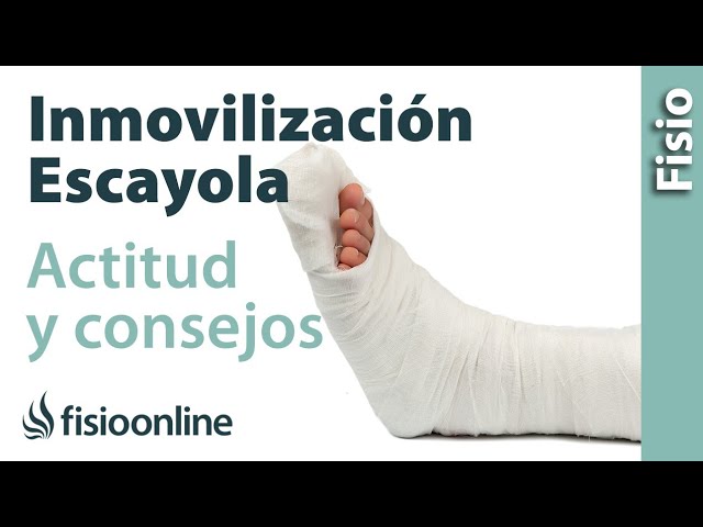 cuanto tiempo hay que tener un yeso