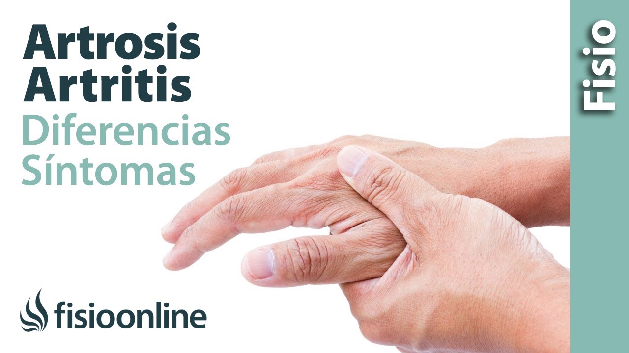 diferencia entre artrosis y artritis reumatoide