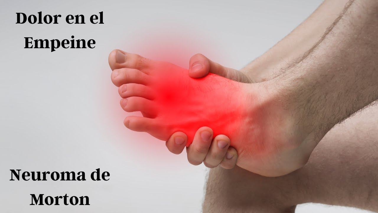 dolor en el empeine al andar