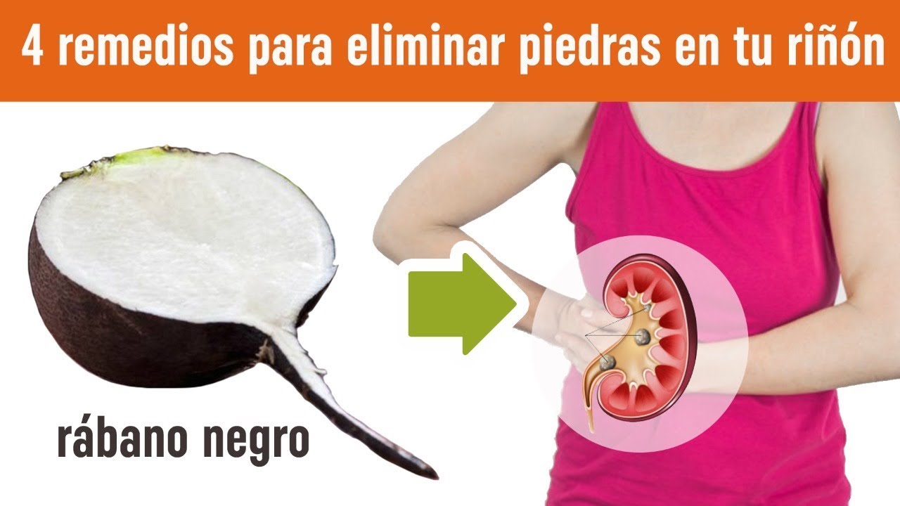 el rabano negro sirve para las piedras en la vesicula