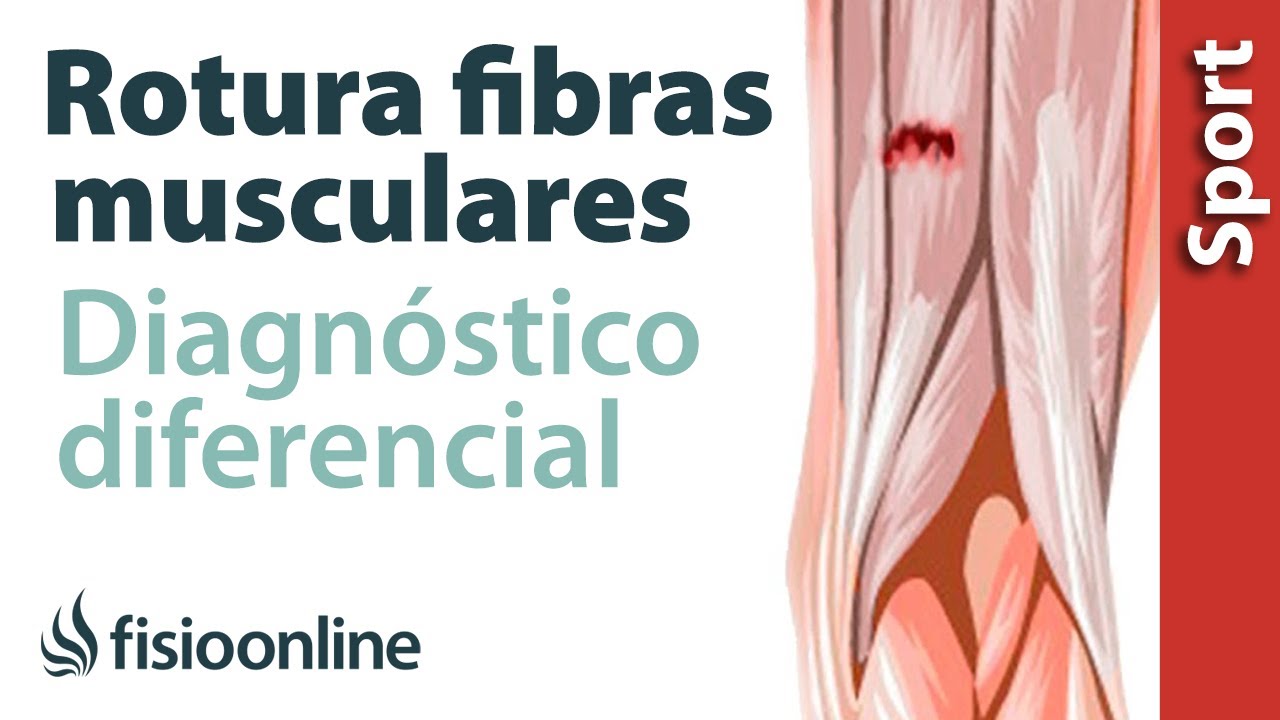 en una resonancia se ve una contractura muscular