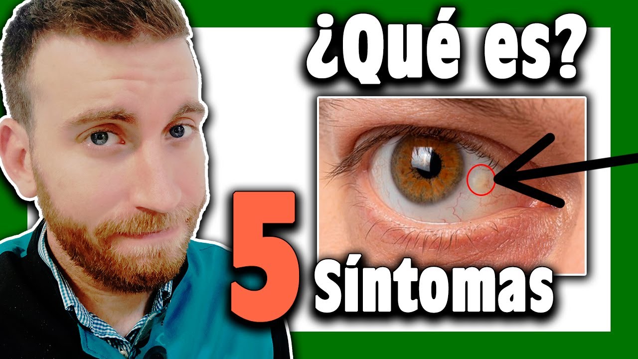 grasa en el interior del ojo