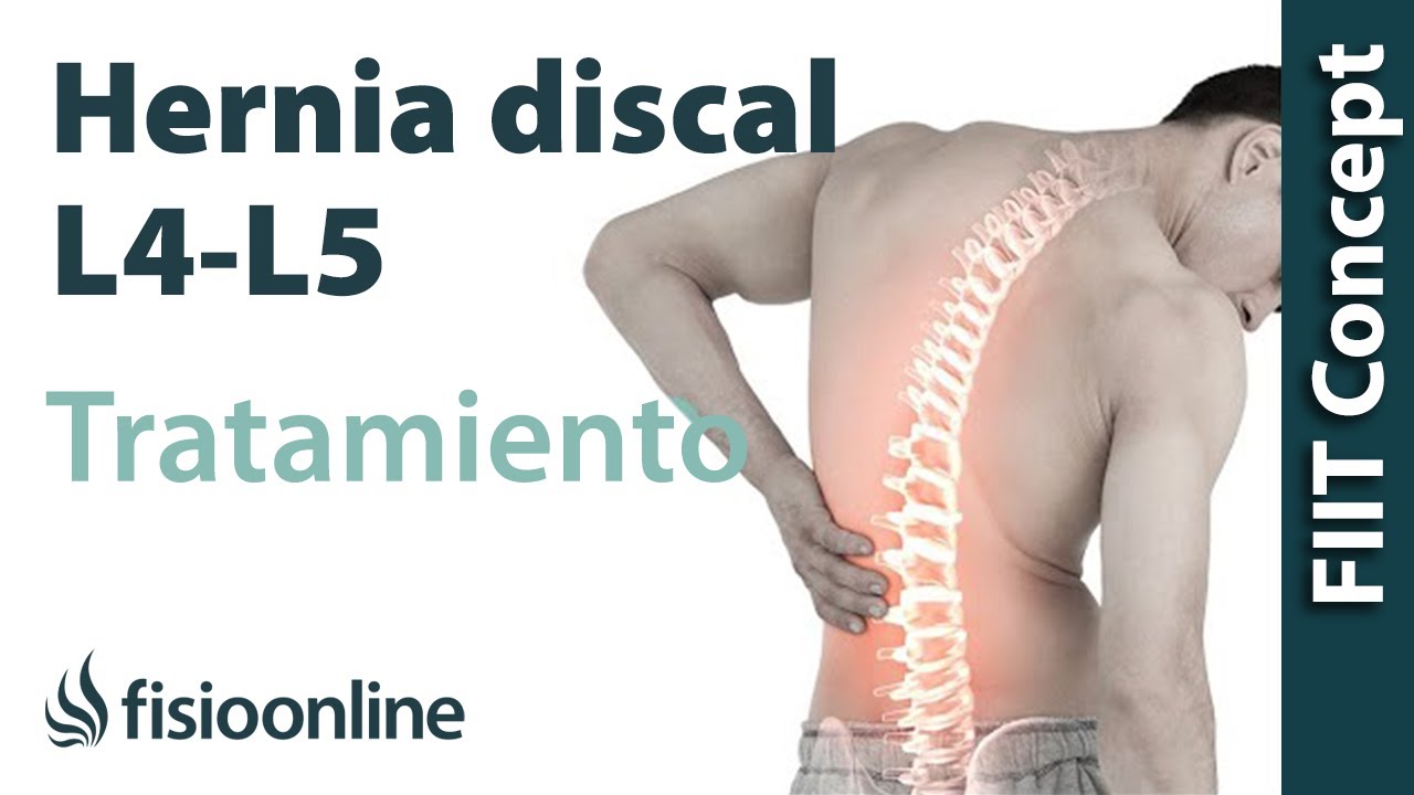 hernia discal l4 l5 tiene cura