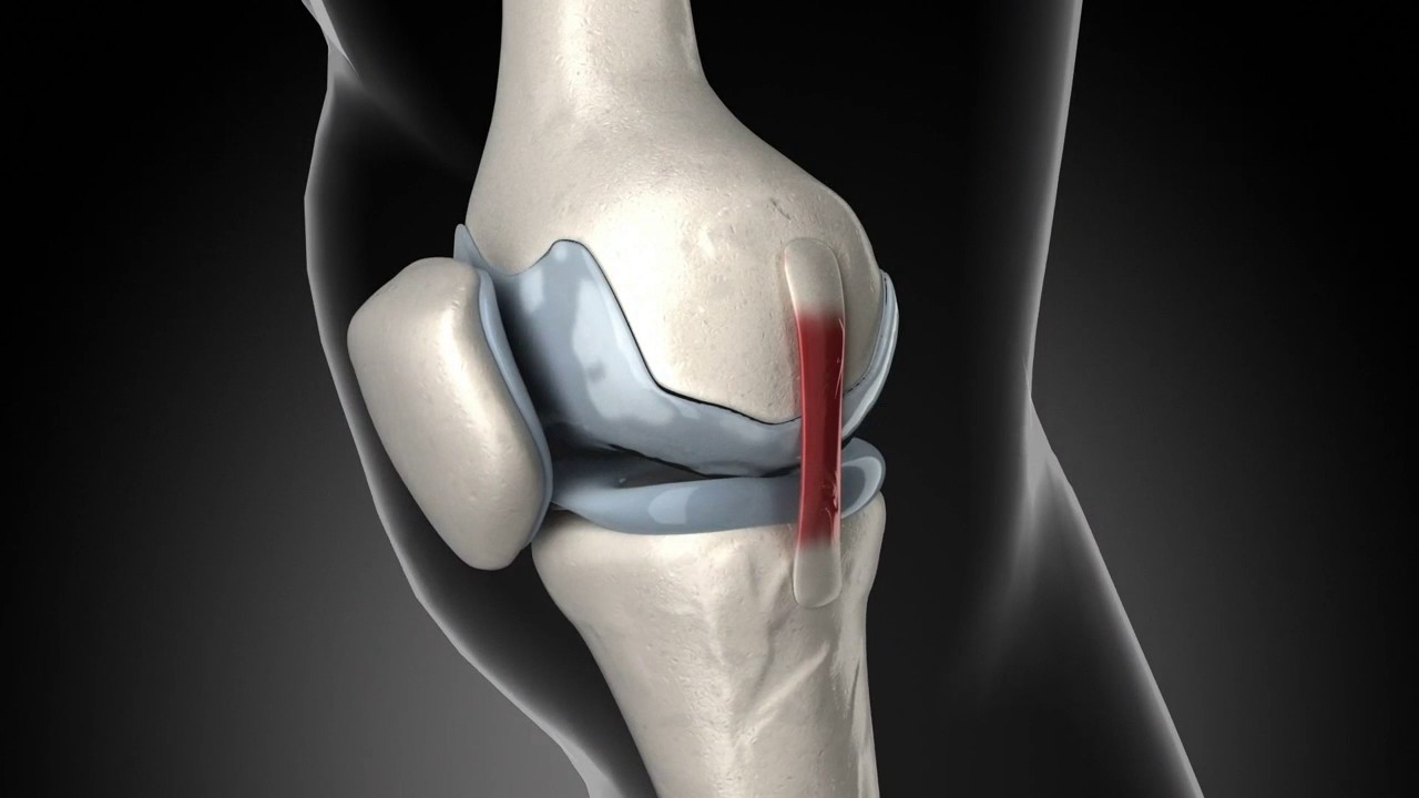 hueso al lado de la rodilla
