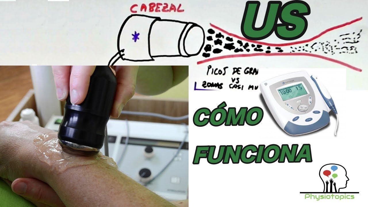 importancia del ultrasonido en la medicina