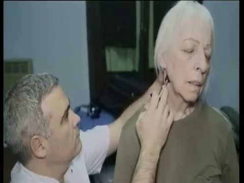 la cervicalgia afecta a la vista