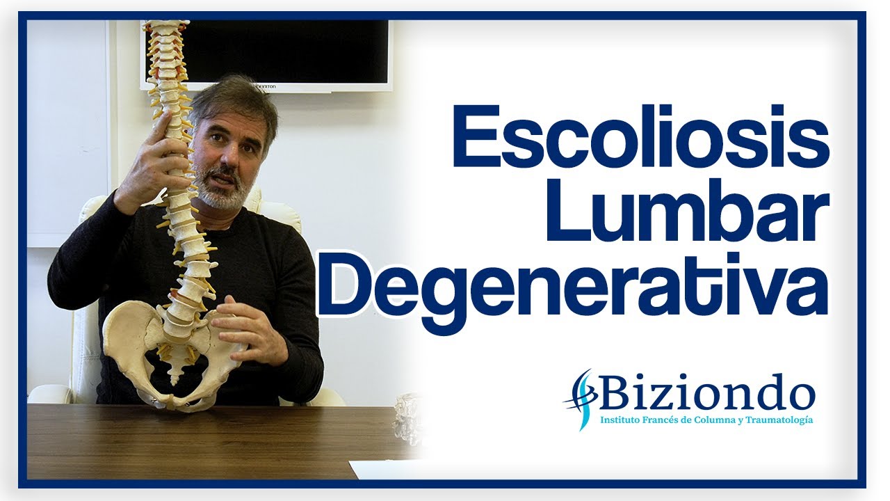 la escoliosis es una enfermedad degenerativa
