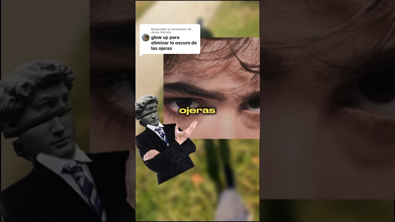 la persona con mas ojeras del mundo