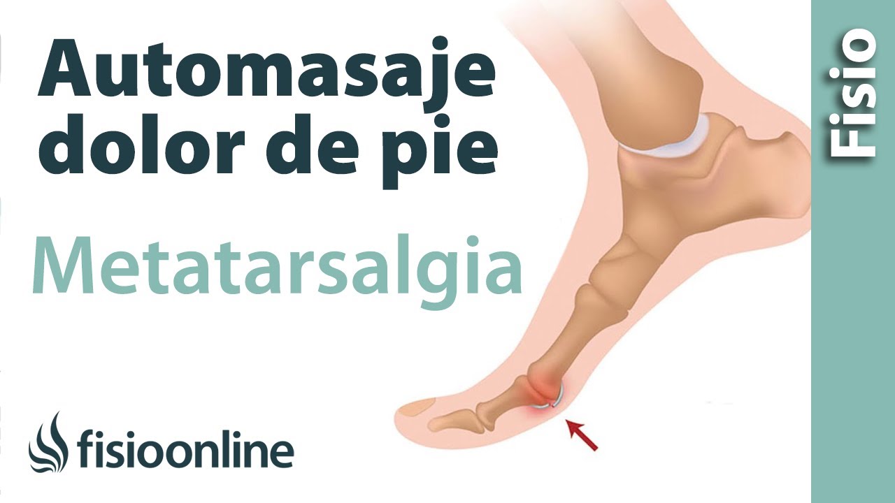 me doble el dedo gordo del pie