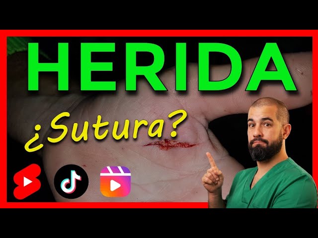 me duelen los puntos de sutura