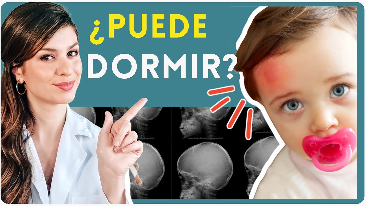 mi hijo se cayo y se golpeo la cabeza