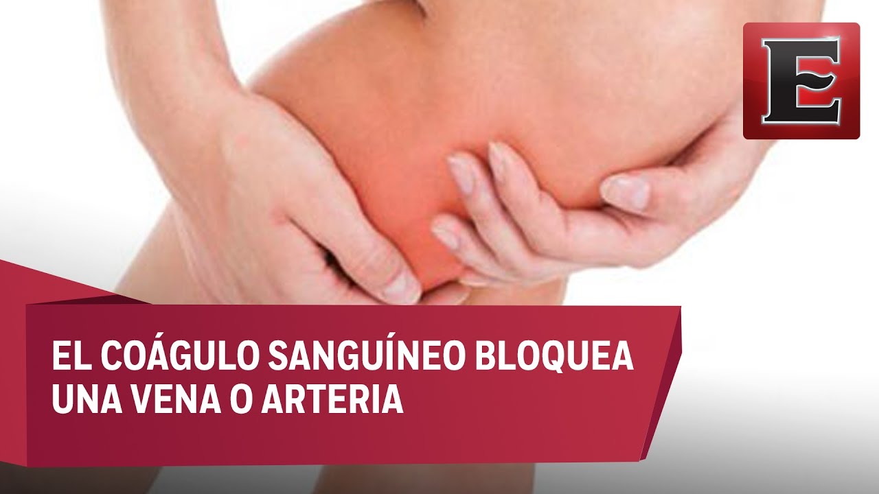 operacion de trombosis en la pierna