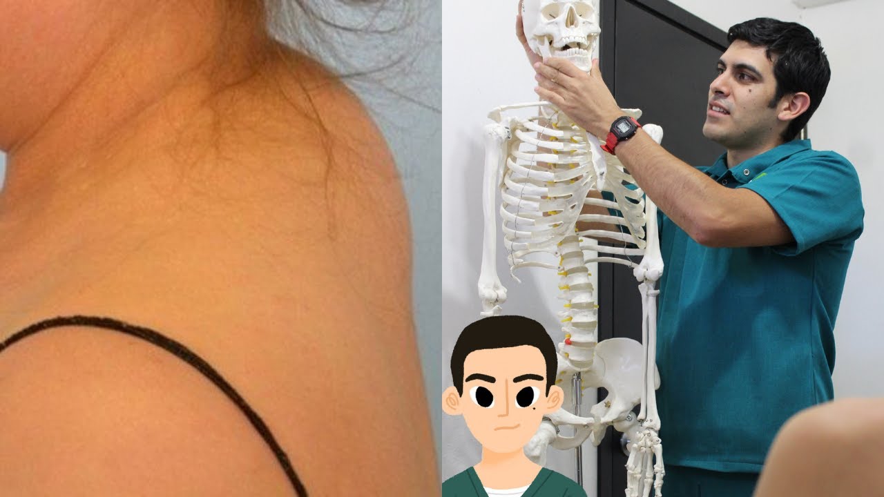 porque tengo joroba en el cuello