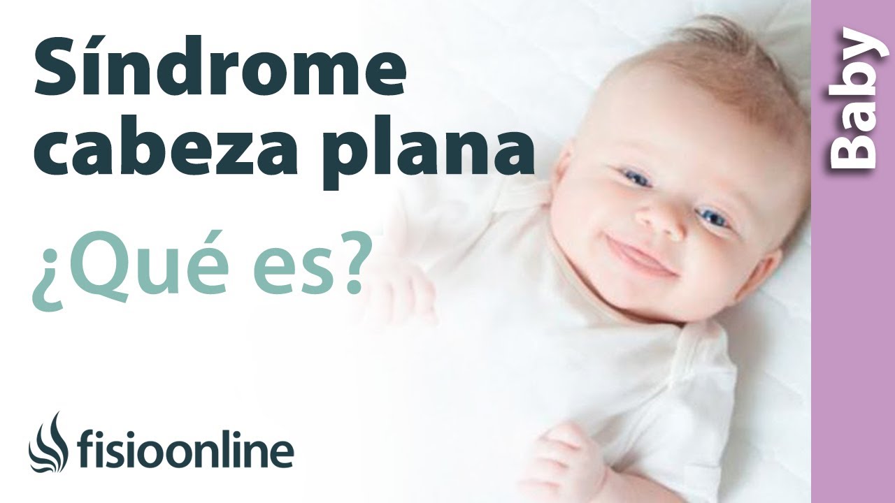 porque tengo la cabeza plana atras