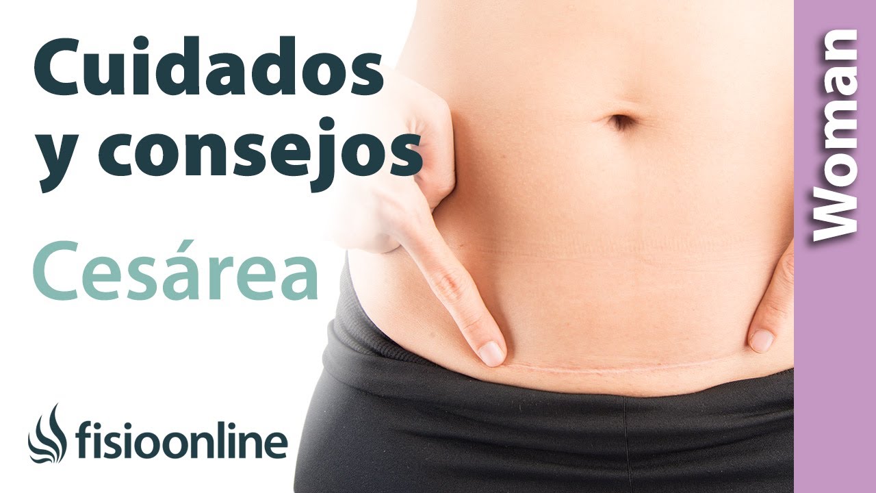 recomendaciones para despues de una cesarea